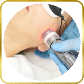 Aknenarbenbehandlung mit Lasertherapie