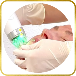 Microneedling mit Radiofrequenzimpulsen